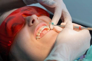 niña con aparato puesto en clínica de estética dental Valencia