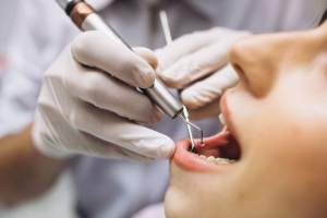 Paciente acude al dentista por enfermedad periodontal