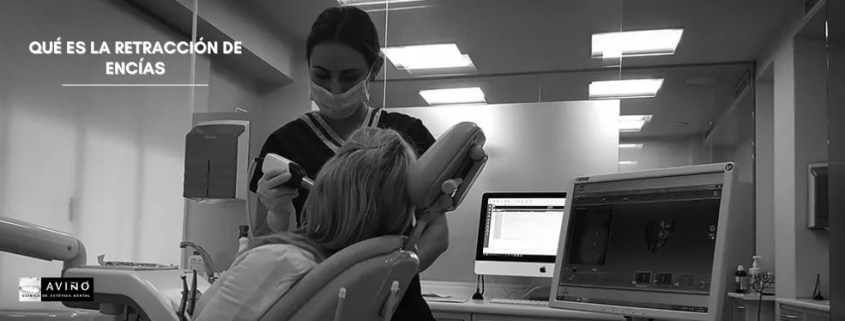 Te contamos qué es la retracción de encías y su tratamiento en nuestra clínica dental de Valencia