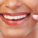 Consejos para cuidar de tus carillas dentales y que duren más tiempo